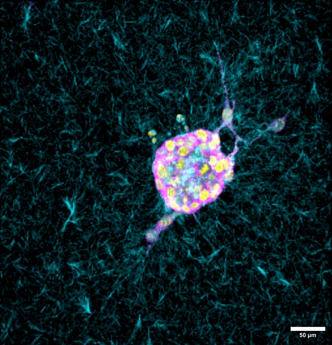 3D reconstruction of a collection of cells, called a cell spheroid.