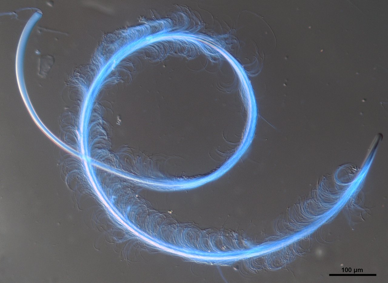 Microscopic view of sperm cells joined together in a cooperative group.
