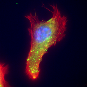 Epifluorescence image of extracellular vimentin with the protein actin and DNA.