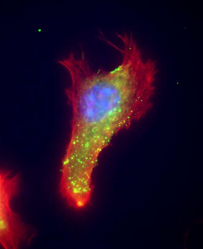 Epifluorescence image of extracellular vimentin