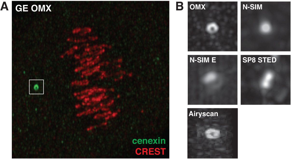 Images of metaphase cell