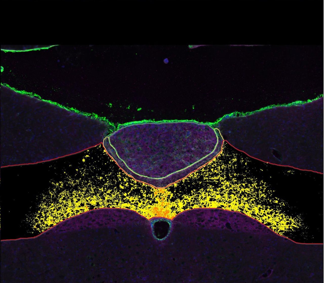 A microscopic view of the hindbrain reveals “support cells” (highlighted in green, red, yellow and purple).