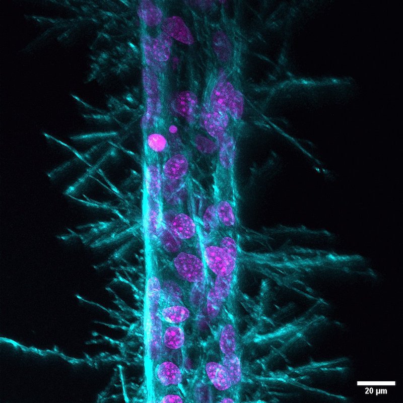 A collaboration between Blatt BioImaging center users, the Physics Department’s Patteson lab, and the Department of Biomedical and Chemical Engineering’s Soman lab produces cool microscopy images!