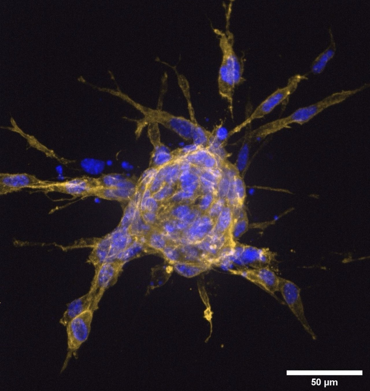 Microscopic image of a fixed and stained mouse embryonic fibroblast spheroid.