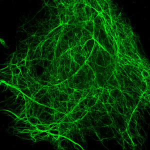 The protein vimentin, pictured in green, helps protect a cell’s nucleus and DNA during migration.