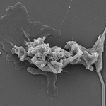 Scanning electron micrograph (SEM) showing an Incendiamoeba wrapping itself around a filamentous bacterium as it feeds, while smaller bacteria coat its surface.