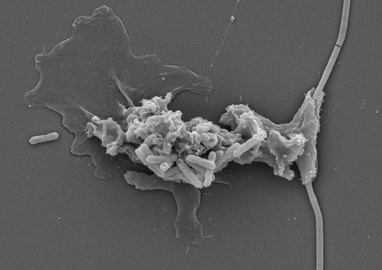 Scanning electron micrograph (SEM) showing an Incendiamoeba wrapping itself around a filamentous bacterium as it feeds, while smaller bacteria coat its surface.