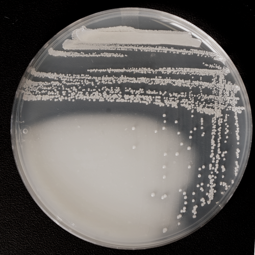 Species of acetic acid bacteria on a petri dish.