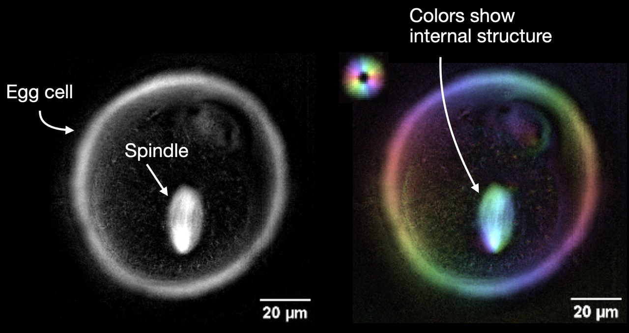 Polarization microscopy of a living mouse egg cell.