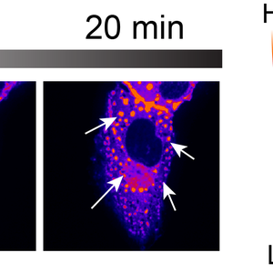 UBQLN2 forming stress-induced condensates in mammalian cells.