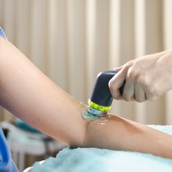 Arm receiving ultrasound therapy.
