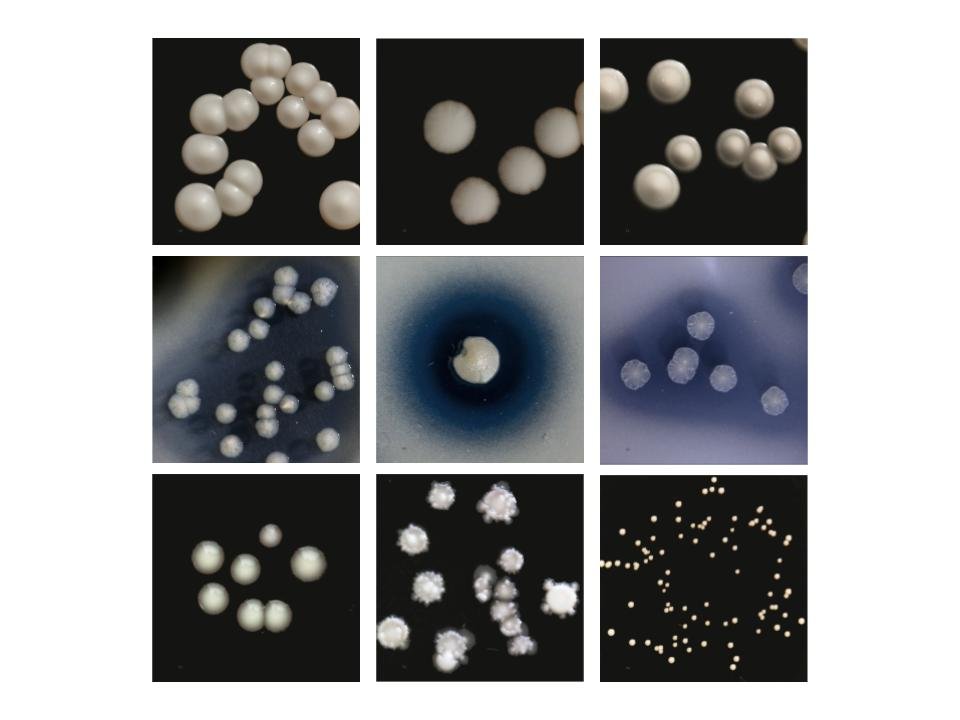 Colonies of the top three most common microbes.