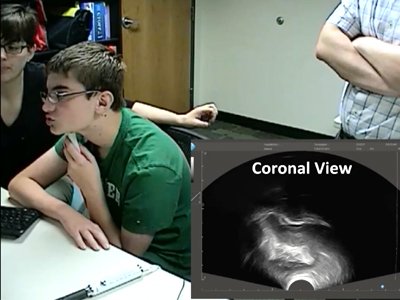 Clinicians at Gebbie Clinic using ultrasound to work with student forming word sounds.